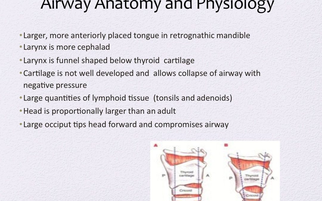 Slide13