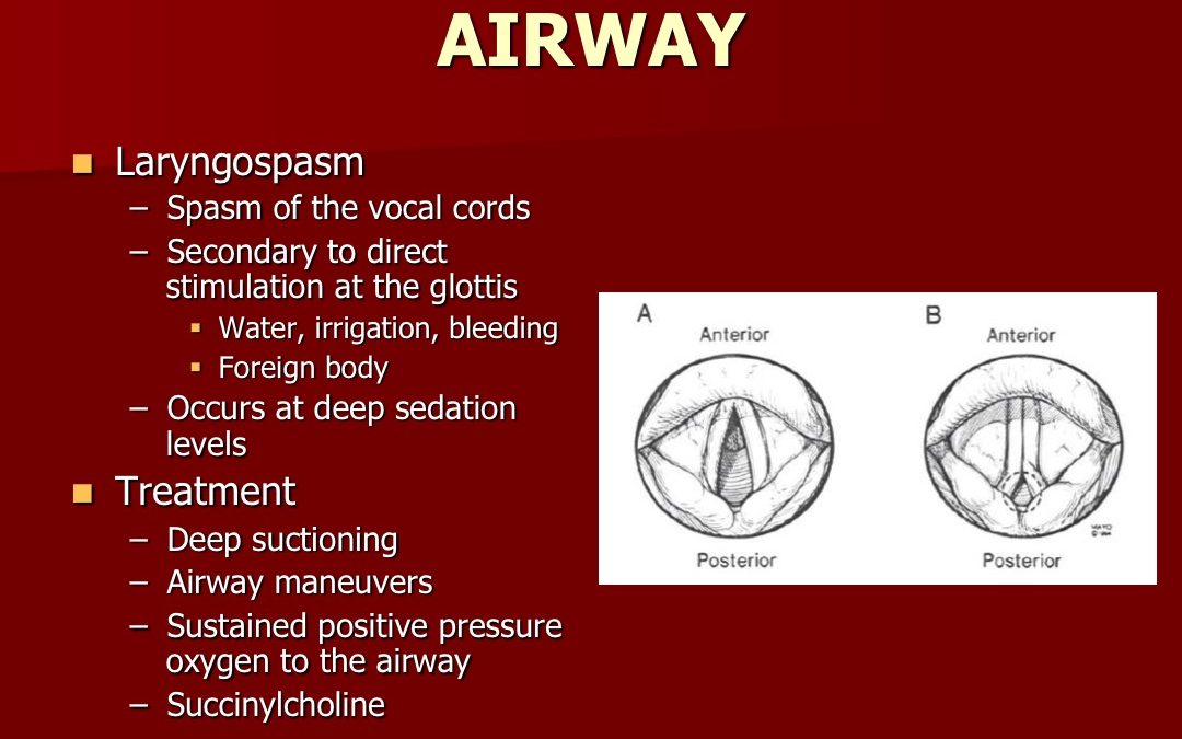 Slide17